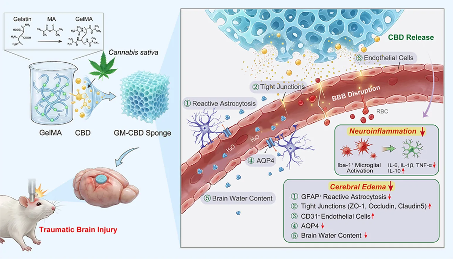 CBD-Loaded Sponge Reduces Brain Swelling and Neuroinflammation After Traumatic Brain Injury, Study Finds